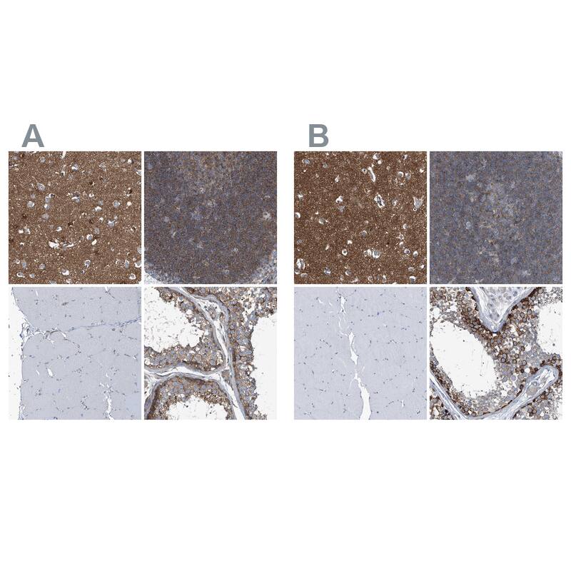 Septin-7 Antibody - BSA Free Immunohistochemistry-Paraffin: Septin-7 Antibody [NBP1-85731]