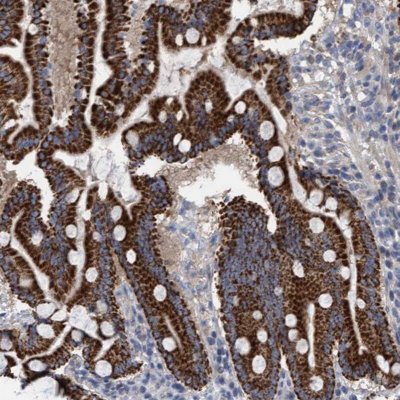 ITFG1 Antibody - BSA Free Immunohistochemistry-Paraffin: ITFG1 Antibody - BSA Free [NBP1-85734]