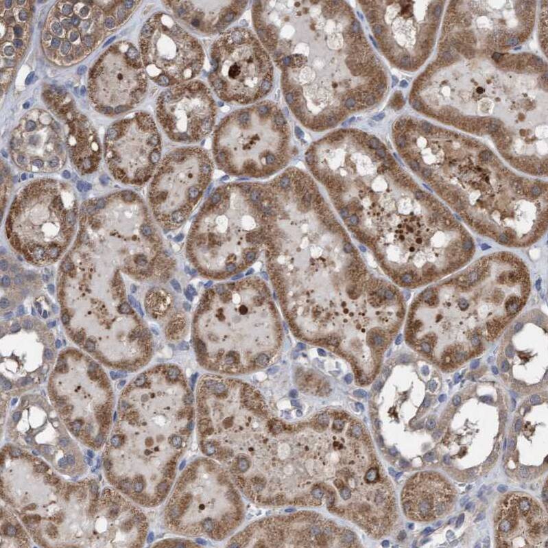 ITFG1 Antibody - BSA Free Immunohistochemistry-Paraffin: ITFG1 Antibody - BSA Free [NBP1-85734]