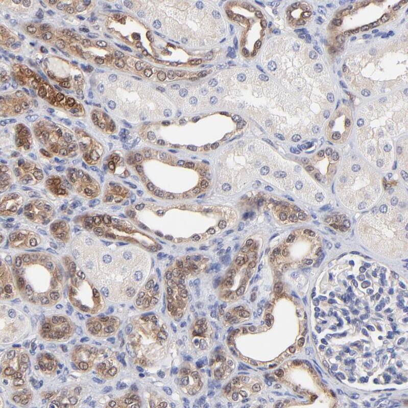 XTP3TPA Antibody - BSA Free Immunohistochemistry-Paraffin: XTP3TPA Antibody - BSA Free [NBP1-85736]