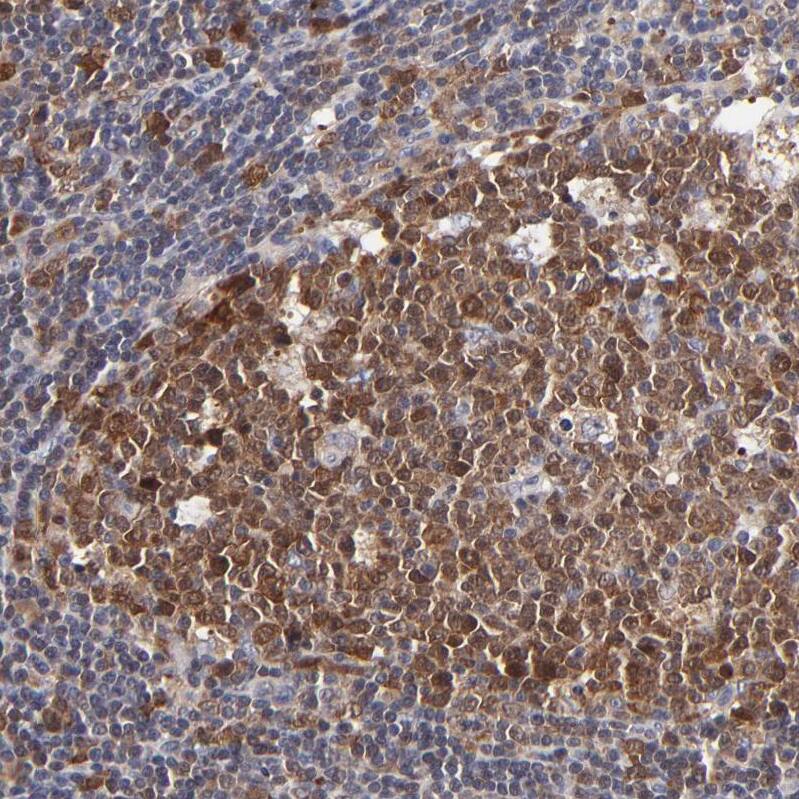 XTP3TPA Antibody - BSA Free Immunohistochemistry-Paraffin: XTP3TPA Antibody - BSA Free [NBP1-85736]