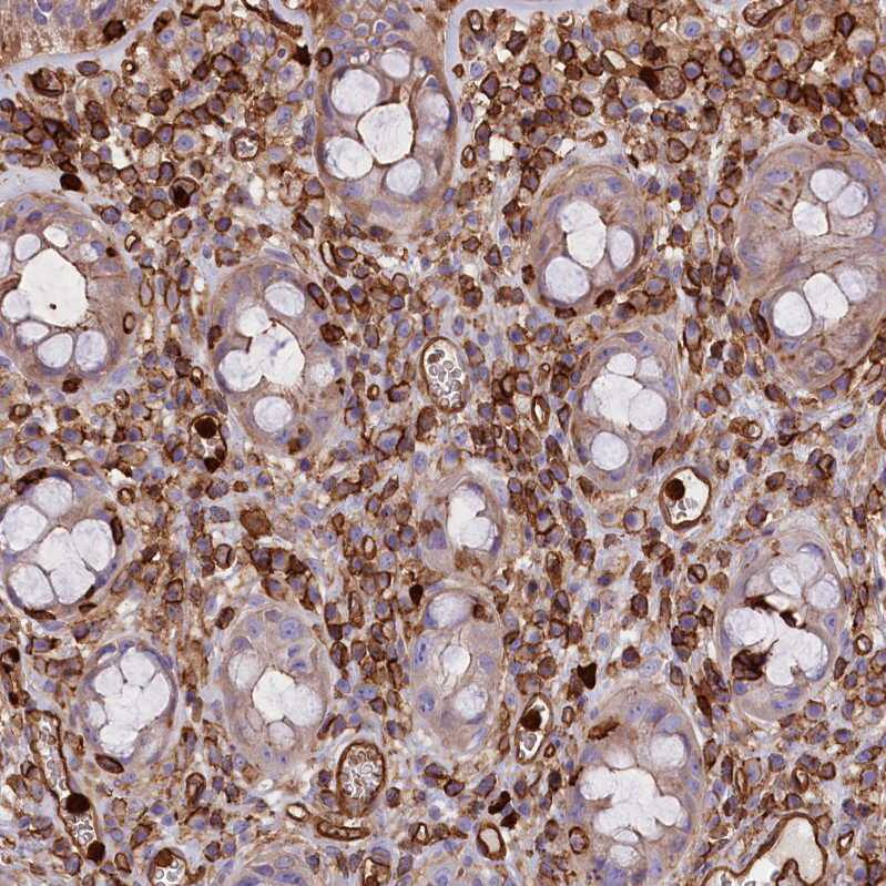 CD99-L2 Antibody - BSA Free Immunohistochemistry-Paraffin: CD99-L2 Antibody - BSA Free [NBP1-85737]