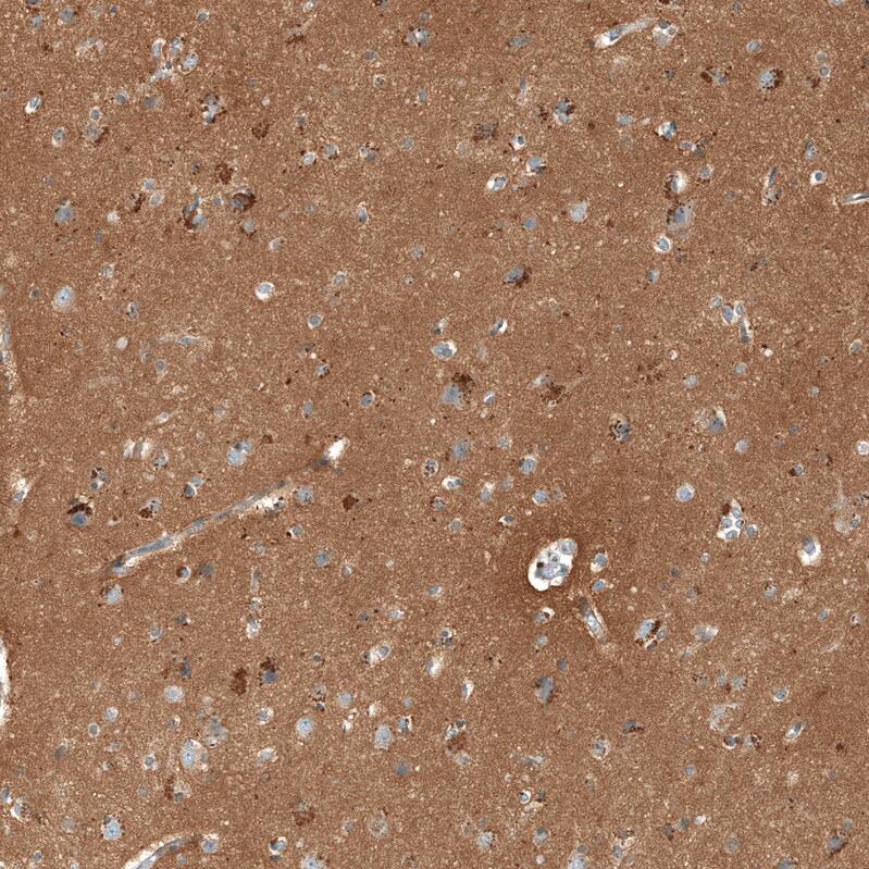 CD90/Thy1 Antibody - BSA Free Immunohistochemistry-Paraffin: CD90/Thy1 Antibody - BSA Free [NBP1-85739]