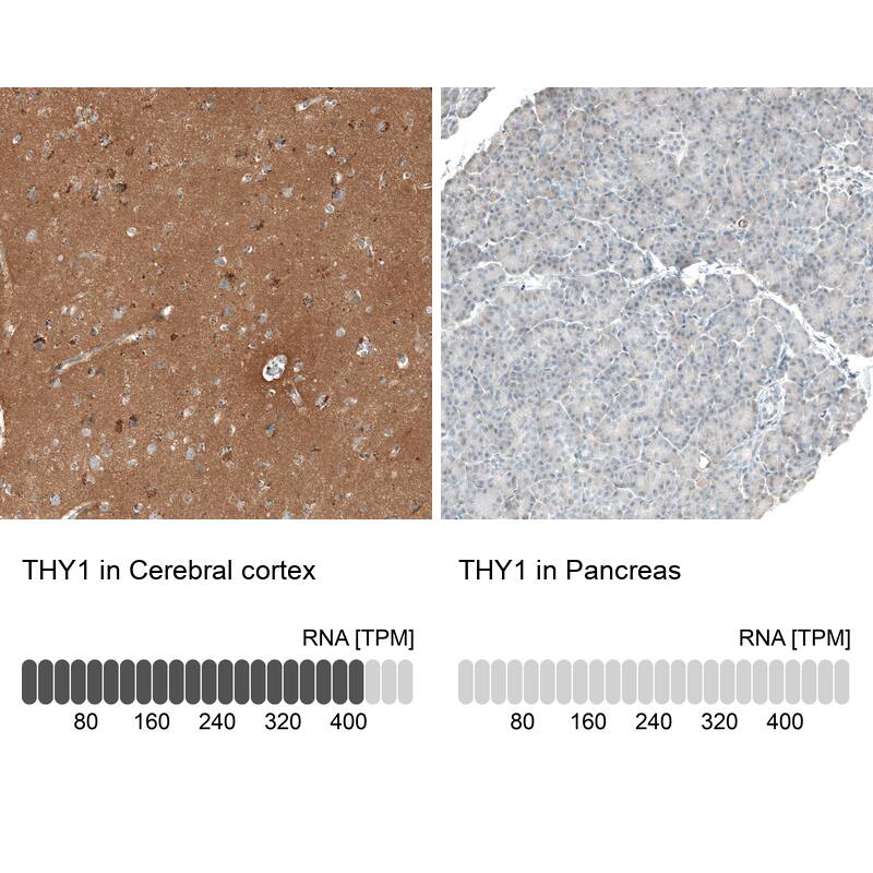 CD90/Thy1 Antibody - BSA Free Immunohistochemistry-Paraffin: CD90/Thy1 Antibody - BSA Free [NBP1-85739]