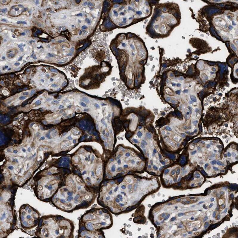 5'-Nucleotidase/CD73 Antibody - BSA Free Immunohistochemistry-Paraffin: 5'-Nucleotidase/CD73 Antibody - BSA Free [NBP1-85740]