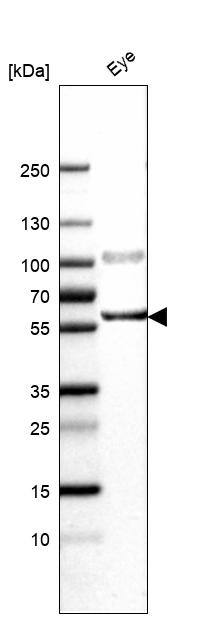 CD39L1/ENTPD2 Antibody - BSA Free Western Blot: CD39L1/ENTPD2 Antibody - BSA Free [NBP1-85752]
