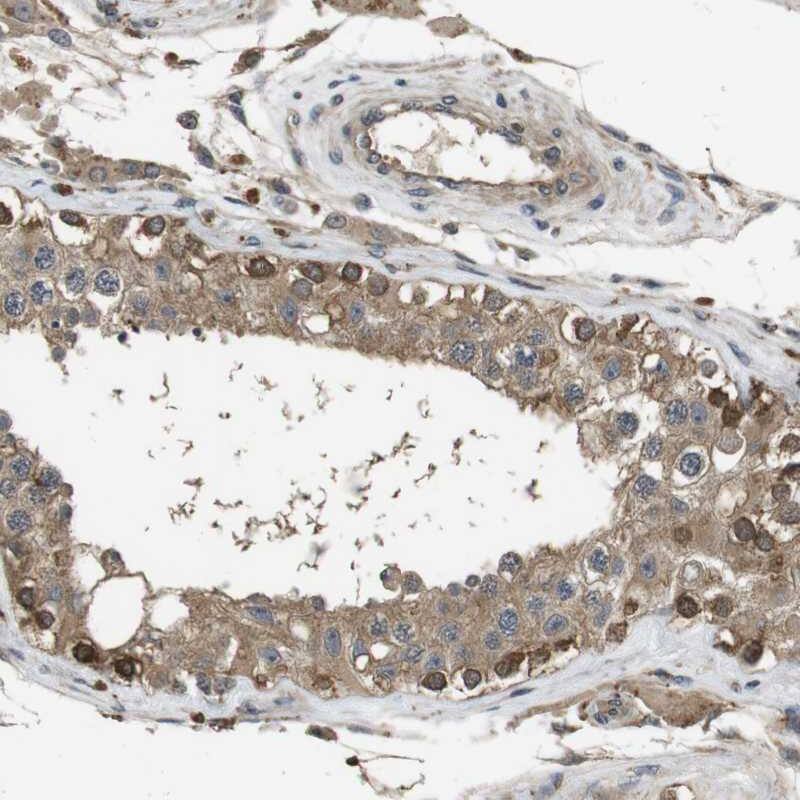 Frizzled-10 Antibody - BSA Free Immunohistochemistry-Paraffin: Frizzled-10 Antibody [NBP1-85753]