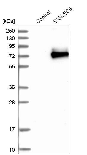 Siglec-6/CD327 Antibody - BSA Free Western Blot: Siglec-6/CD327 Antibody - BSA Free [NBP1-85757]