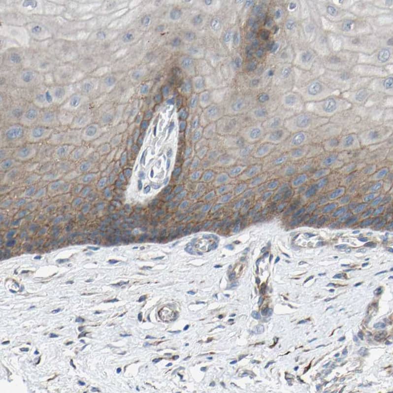 CDCP1 Antibody - BSA Free Immunohistochemistry-Paraffin: CDCP1 Antibody - BSA Free [NBP1-85758]