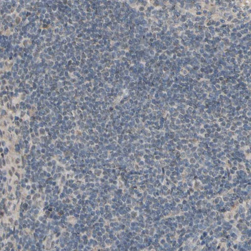 CDCP1 Antibody - BSA Free Immunohistochemistry-Paraffin: CDCP1 Antibody - BSA Free [NBP1-85759]