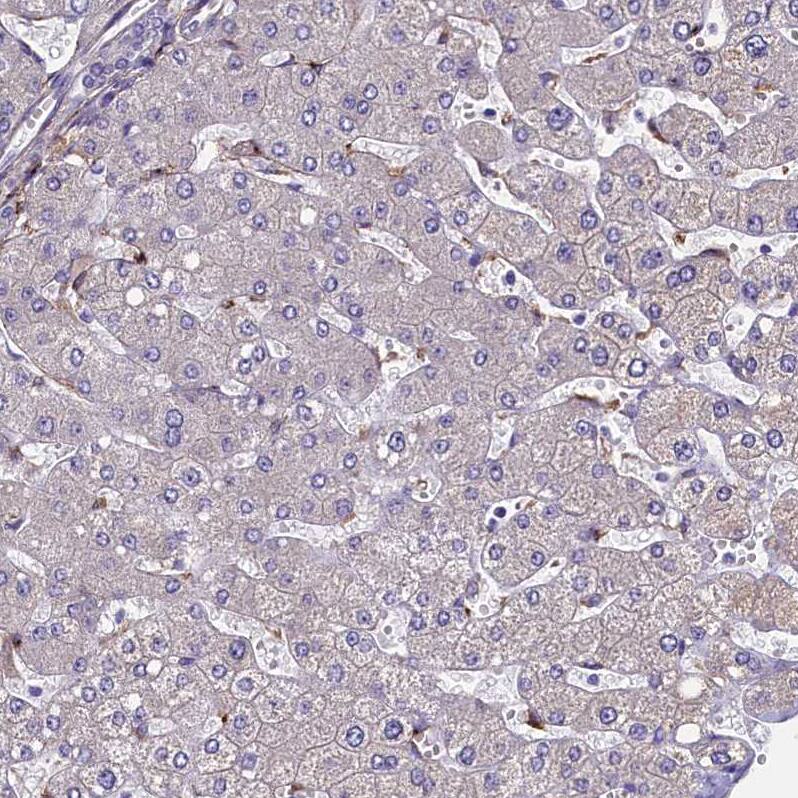 Mrc2 Antibody - BSA Free Immunohistochemistry-Paraffin: Mrc2 Antibody - BSA Free [NBP1-85768]