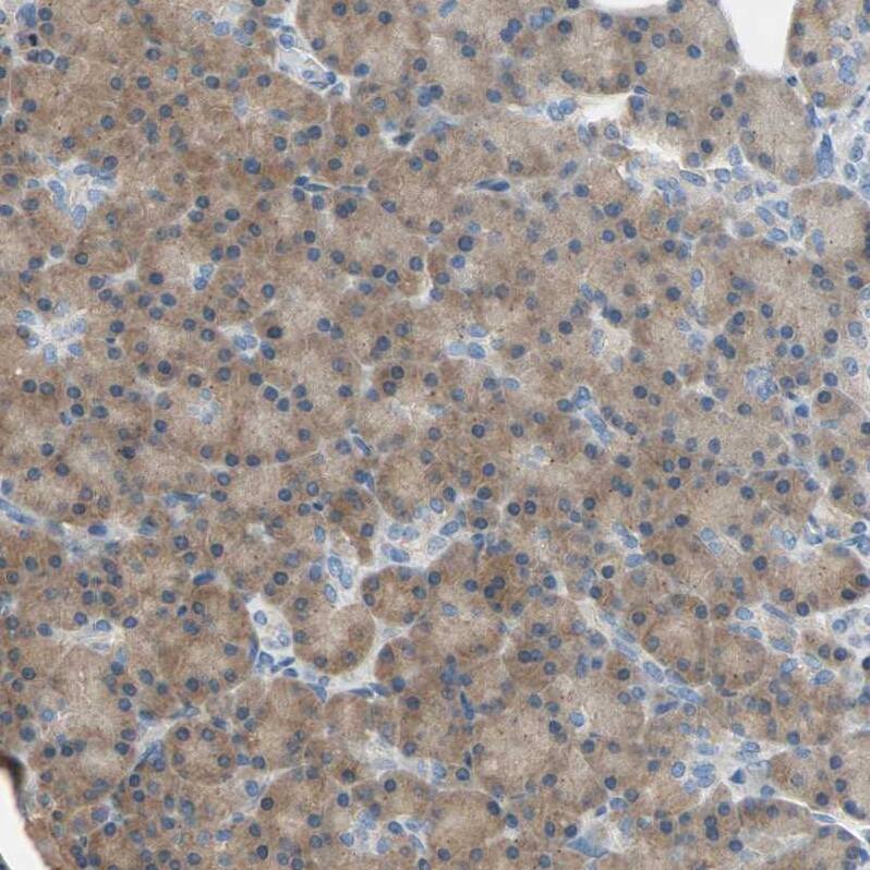 TWEAK R/TNFRSF12 Antibody - BSA Free Immunohistochemistry-Paraffin: TWEAK R/TNFRSF12 Antibody - BSA Free [NBP1-85770]