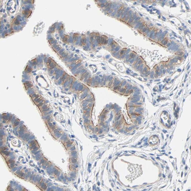 TWEAK R/TNFRSF12 Antibody - BSA Free Immunohistochemistry-Paraffin: TWEAK R/TNFRSF12 Antibody - BSA Free [NBP1-85770]