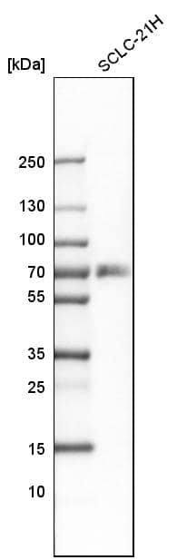 RANK/TNFRSF11A Antibody - BSA Free Western Blot: RANK/TNFRSF11A Antibody - BSA Free [NBP1-85771]