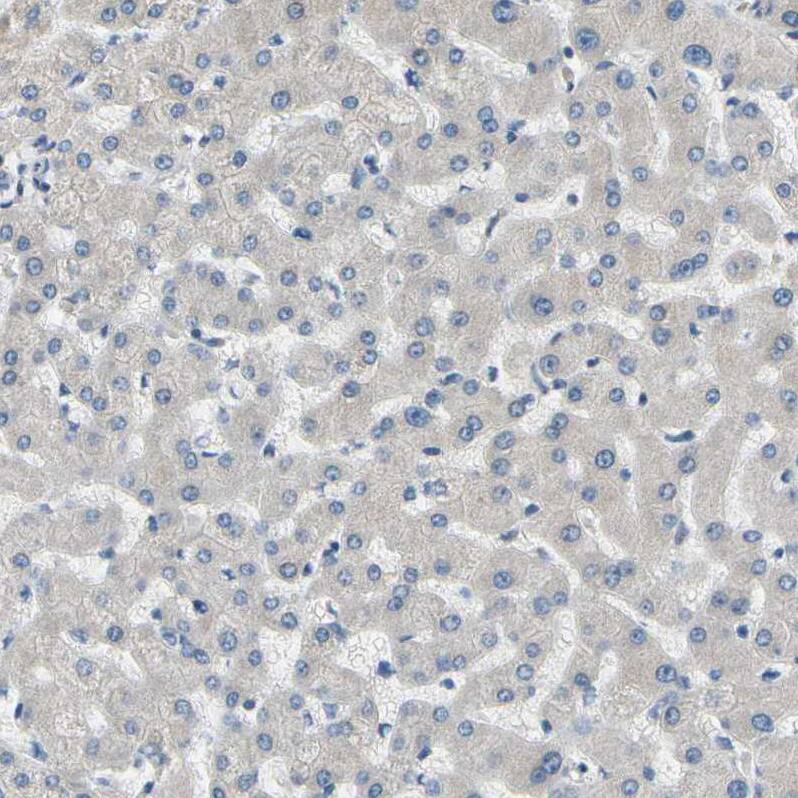 CD23/Fc epsilon RII Antibody - BSA Free Immunohistochemistry-Paraffin: CD23/Fc epsilon RII Antibody - BSA Free [NBP1-85776]