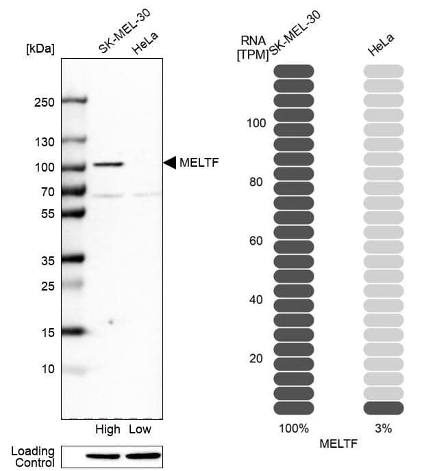 Melanotransferrin/CD228/MFI2 Antibody - BSA Free Western Blot: Melanotransferrin/CD228/MFI2 Antibody - BSA Free [NBP1-85777]