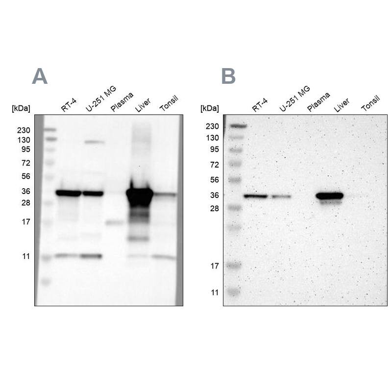 ACAA1 Antibody - BSA Free Western Blot: ACAA1 Antibody - BSA Free [NBP1-85786]