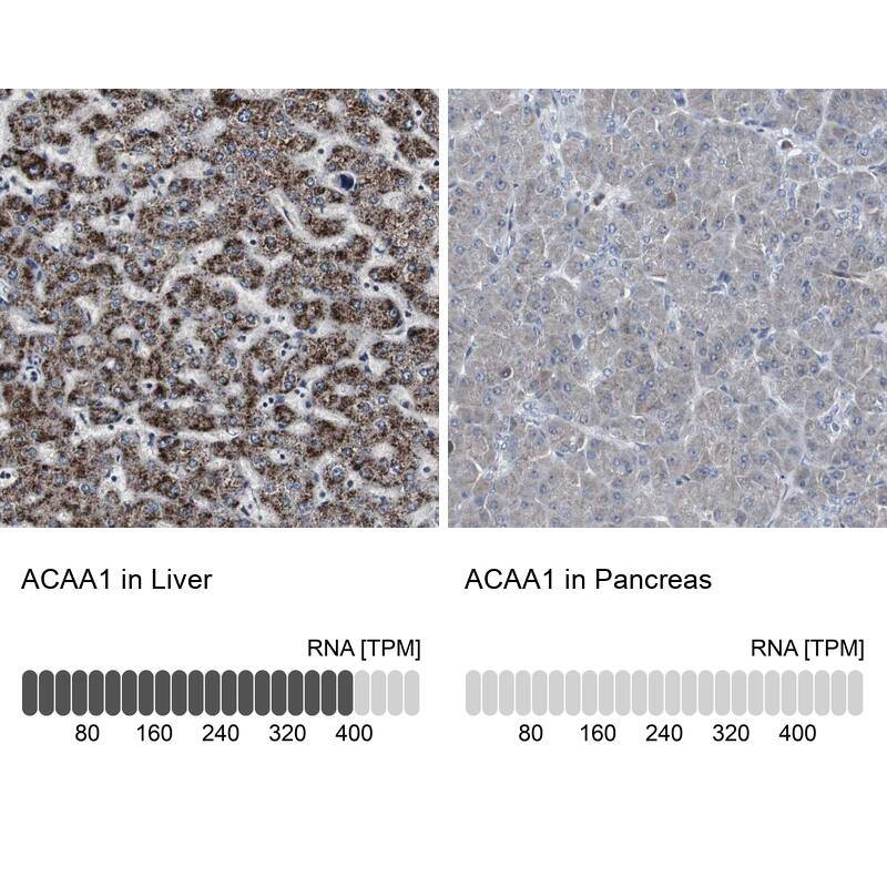 ACAA1 Antibody - BSA Free Immunohistochemistry-Paraffin: ACAA1 Antibody - BSA Free [NBP1-85786]