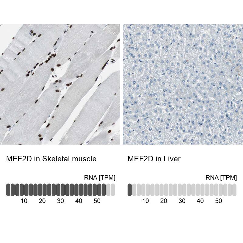 MEF2D Antibody - BSA Free Immunohistochemistry-Paraffin: MEF2D Antibody - BSA Free [NBP1-85788]