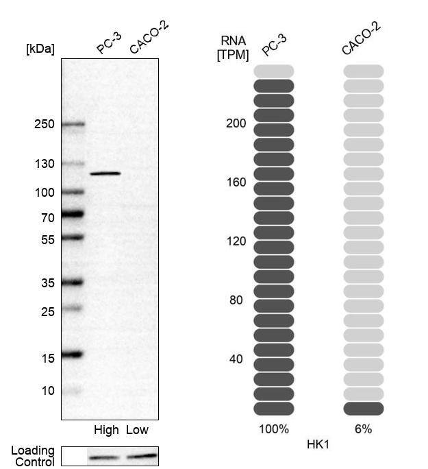 Hexokinase 1 Antibody - BSA Free Western Blot: Hexokinase 1 Antibody - BSA Free [NBP1-85789]
