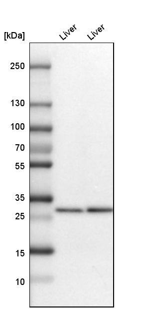 Ketohexokinase Antibody - BSA Free Western Blot: Ketohexokinase Antibody - BSA Free [NBP1-85790]