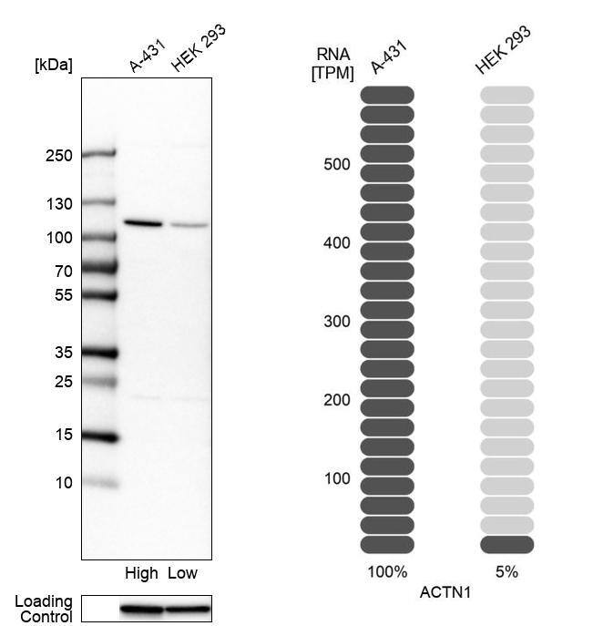 alpha-Actinin 1 Antibody - BSA Free Western Blot: alpha-Actinin 1 Antibody - BSA Free [NBP1-85791]