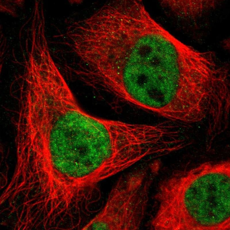 DLX5 Antibody - BSA Free Immunocytochemistry/ Immunofluorescence: DLX5 Antibody [NBP1-85793]