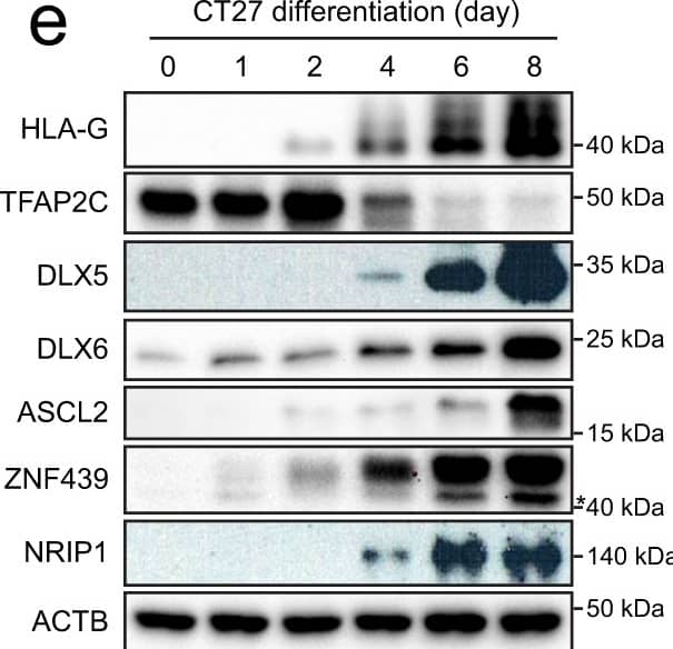 DLX5 Antibody - BSA Free
