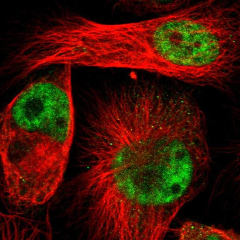 ZMAT5 Antibody - BSA Free Immunocytochemistry/ Immunofluorescence: ZMAT5 Antibody [NBP1-85794]