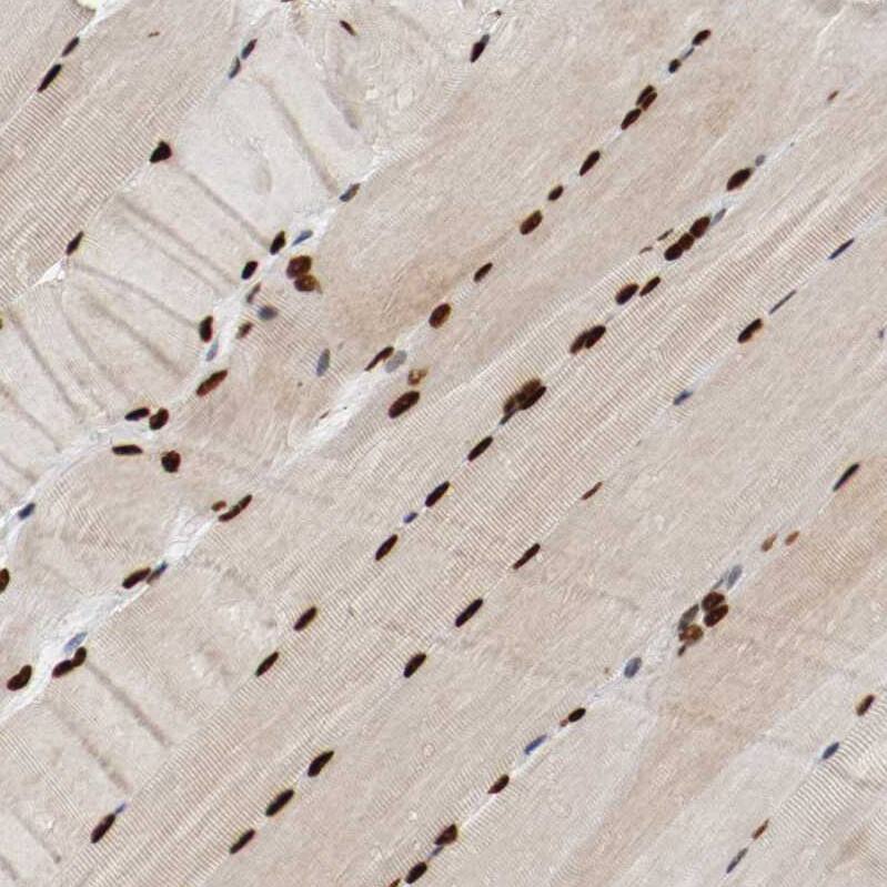 MEF2D Antibody - BSA Free Immunohistochemistry-Paraffin: MEF2D Antibody - BSA Free [NBP1-85795]