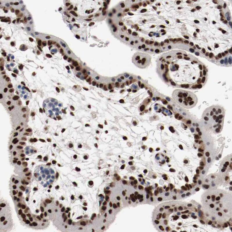 MEF2D Antibody - BSA Free Immunohistochemistry-Paraffin: MEF2D Antibody - BSA Free [NBP1-85795]