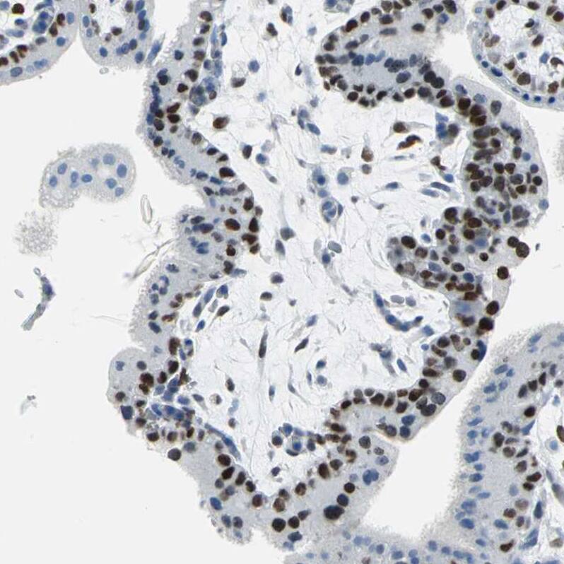 MCM3 Antibody - BSA Free Immunohistochemistry-Paraffin: MCM3 Antibody - BSA Free [NBP1-85796]
