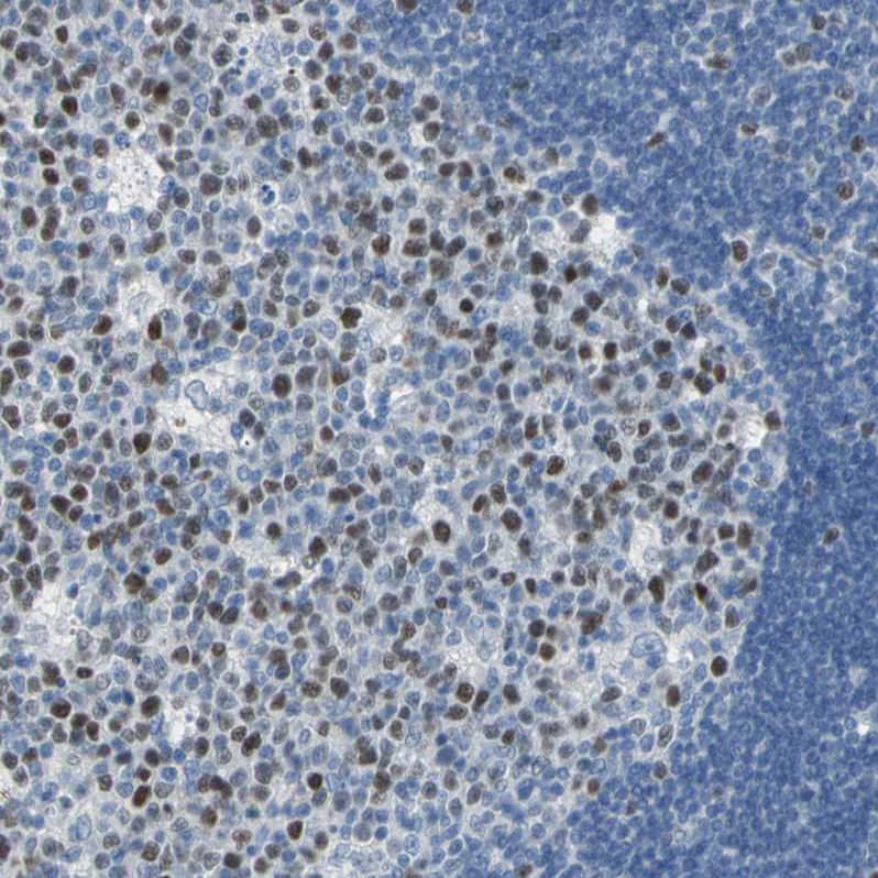 MCM3 Antibody - BSA Free Immunohistochemistry-Paraffin: MCM3 Antibody - BSA Free [NBP1-85796]