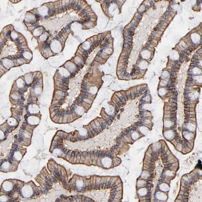PDLIM2 Antibody - BSA Free Immunohistochemistry-Paraffin: PDLIM2 Antibody - BSA Free [NBP1-85800]