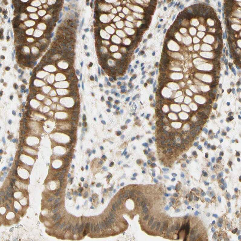 PAK1 Antibody - BSA Free Immunohistochemistry-Paraffin: PAK1 Antibody - BSA Free [NBP1-85802]