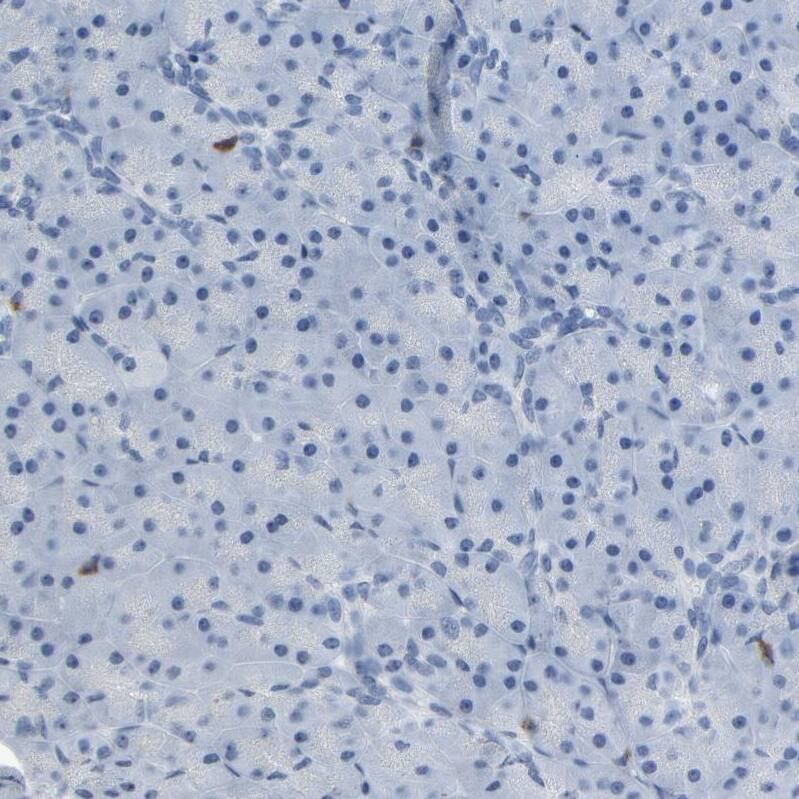 Lck Antibody - BSA Free Immunohistochemistry-Paraffin: Lck Antibody - BSA Free [NBP1-85804]