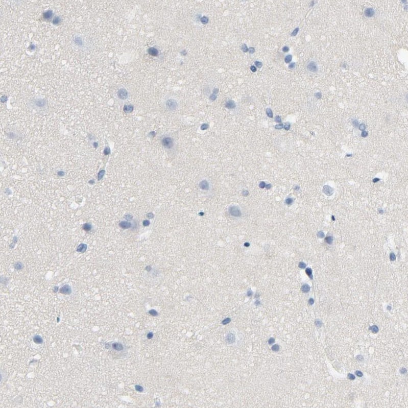 Lck Antibody - BSA Free Immunohistochemistry-Paraffin: Lck Antibody - BSA Free [NBP1-85804]