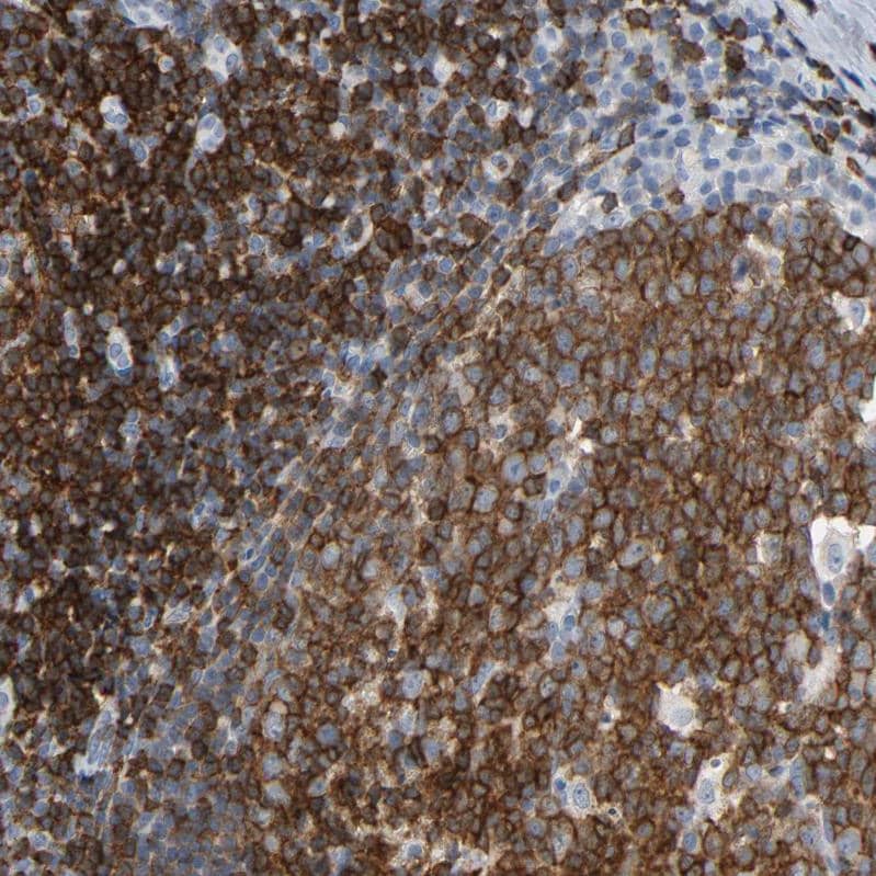 Lck Antibody - BSA Free Immunohistochemistry-Paraffin: Lck Antibody - BSA Free [NBP1-85804]