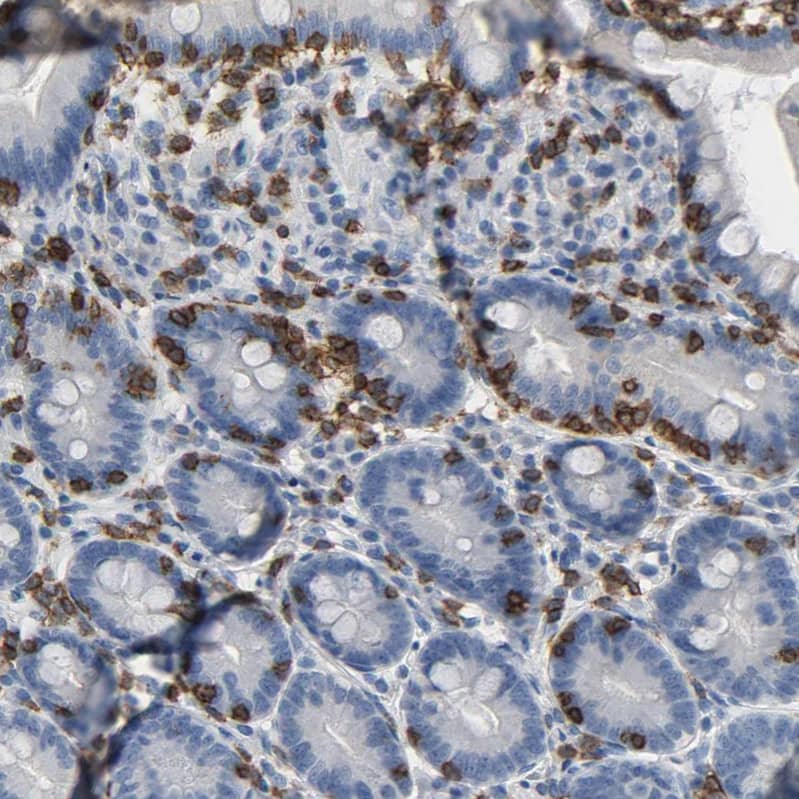 Lck Antibody - BSA Free Immunohistochemistry-Paraffin: Lck Antibody - BSA Free [NBP1-85804]