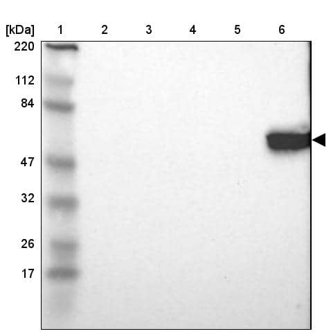 Lck Antibody - BSA Free Western Blot: Lck Antibody - BSA Free [NBP1-85804]