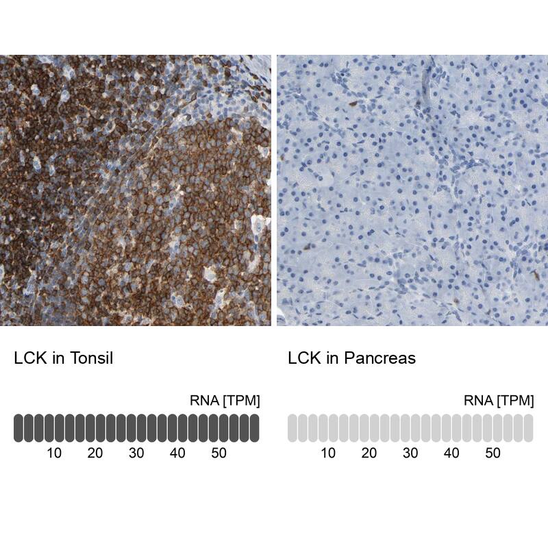 Lck Antibody - BSA Free Immunohistochemistry-Paraffin: Lck Antibody - BSA Free [NBP1-85804]