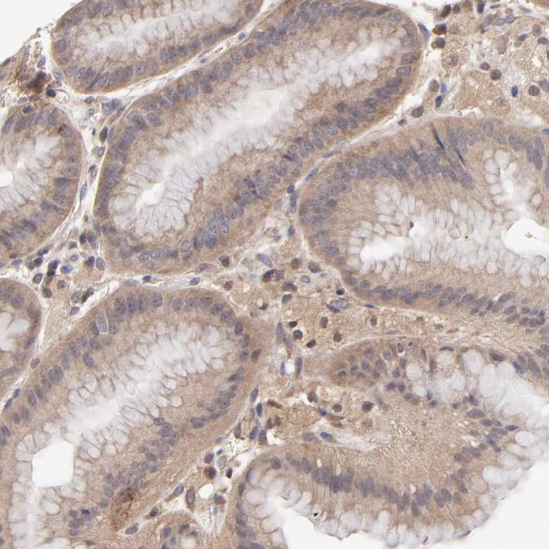PCMT1 Antibody - BSA Free Immunohistochemistry-Paraffin: PCMT1 Antibody [NBP1-85806]