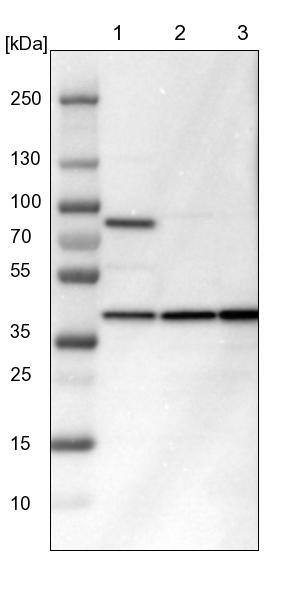 IDH3G Antibody - BSA Free Western Blot: IDH3G Antibody - BSA Free [NBP1-85810]