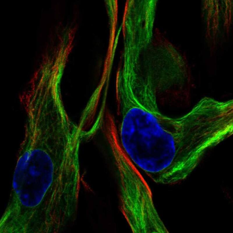 Vimentin Antibody - BSA Free Immunocytochemistry/ Immunofluorescence: Vimentin Antibody [NBP1-85814]