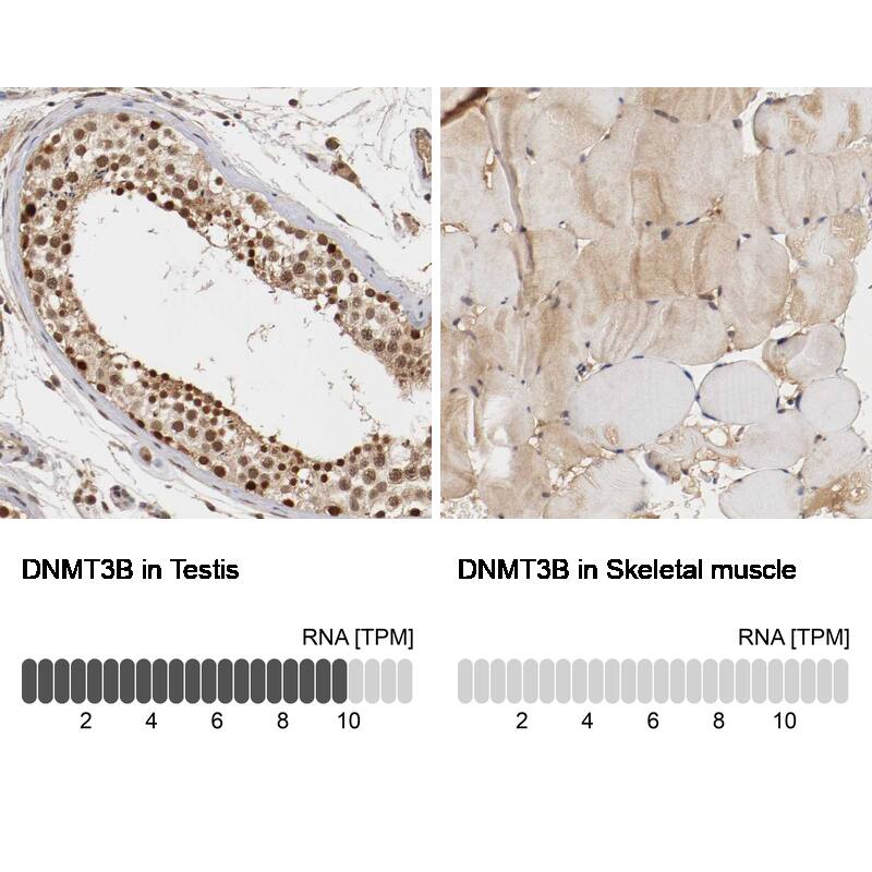 DNMT3B Antibody - BSA Free Immunohistochemistry-Paraffin: DNMT3B Antibody - BSA Free [NBP1-85815]