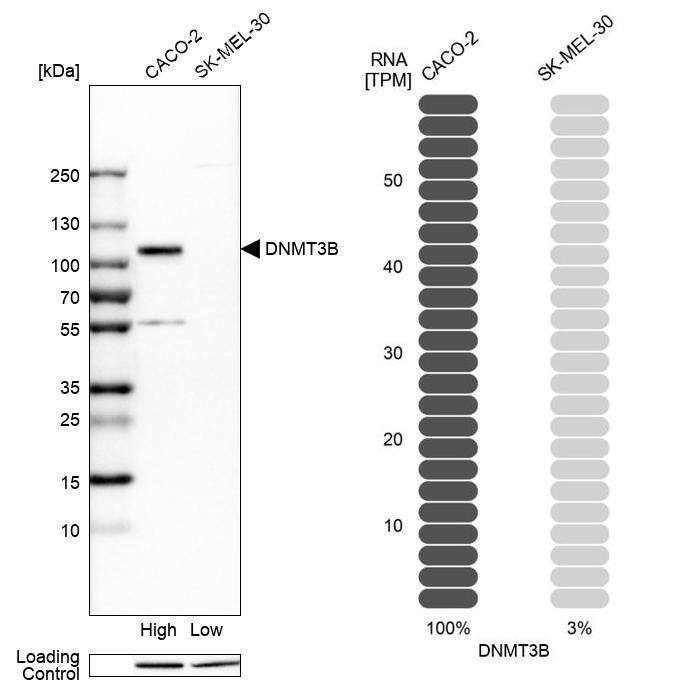 DNMT3B Antibody - BSA Free Western Blot: DNMT3B Antibody - BSA Free [NBP1-85815]
