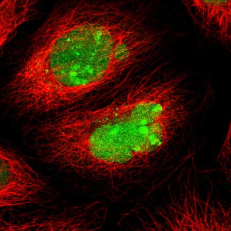 ATF3 Antibody - BSA Free Immunocytochemistry/ Immunofluorescence: ATF3 Antibody - BSA Free [NBP1-85816]
