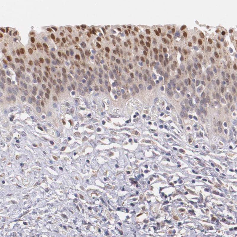 ATF3 Antibody - BSA Free Immunohistochemistry-Paraffin: ATF3 Antibody - BSA Free [NBP1-85816]
