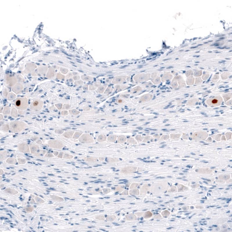 ATF3 Antibody - BSA Free Immunohistochemistry-Paraffin: ATF3 Antibody - BSA Free [NBP1-85816]