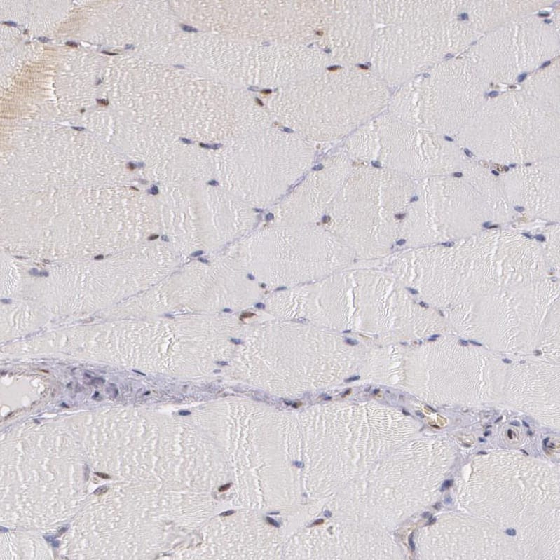 ATF3 Antibody - BSA Free Immunohistochemistry-Paraffin: ATF3 Antibody - BSA Free [NBP1-85816]